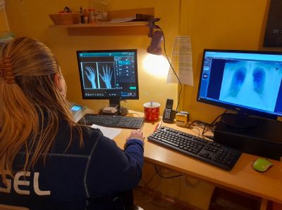 Nemocnice AGEL Jeseník provedla díky digitálním rentgenovým snímkům za rok a půl téměř 30 000 vyšetření